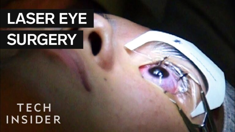 Lucrative Eye Surgery Jobs: High Salary & Exciting Career!