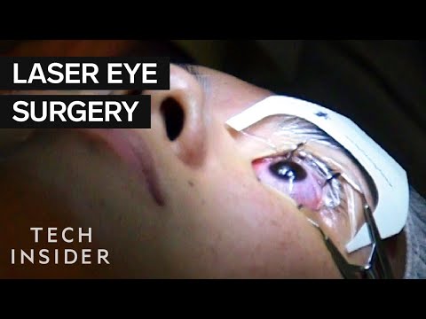 Eye Surgery Salary and Job Description